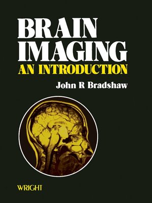 cover image of Brain Imaging